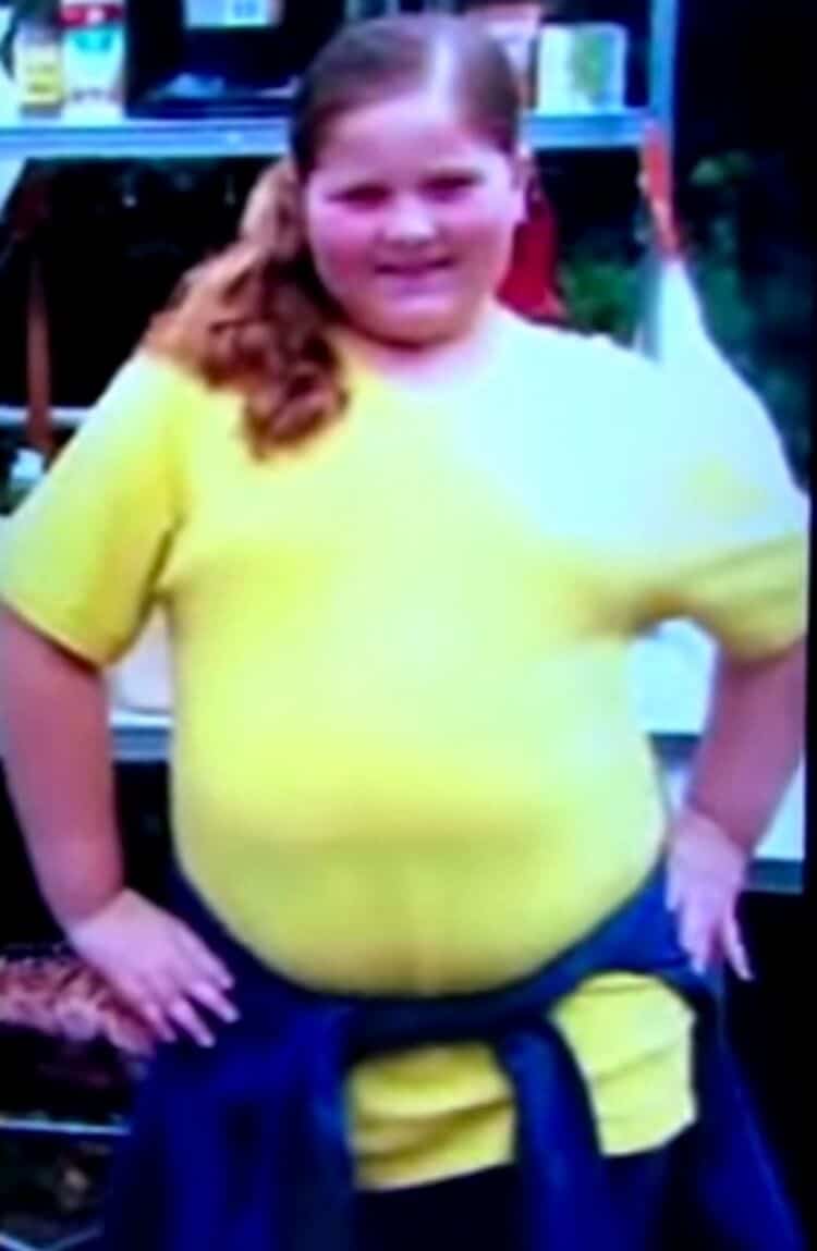 Толстая девочка 11. Дети с ожирением девочки.