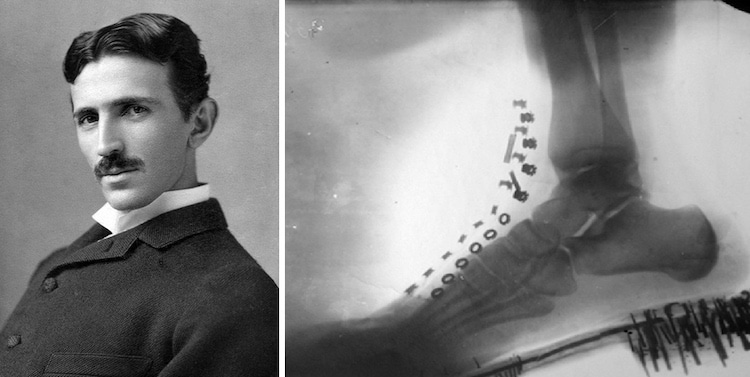 Nikola Tesla and Radiography